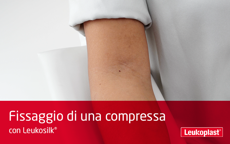 Qui possiamo vedere in primo piano come una compressa viene fissata utilizzando un cerotto su rocchetto per pelli delicate: un operatore sanitario sta applicando un tampone sulla piega del braccio del paziente con Leukosilk. Qui possiamo vedere in primo piano come una compressa viene fissata utilizzando un cerotto su rocchetto per pelli delicate: un operatore sanitario sta applicando un tampone sulla piega del braccio del paziente con Leukosilk.